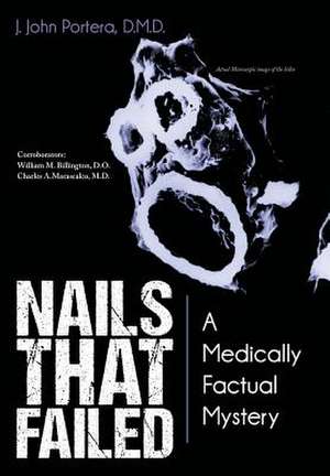 Nails That Failed de J John Portera D M D
