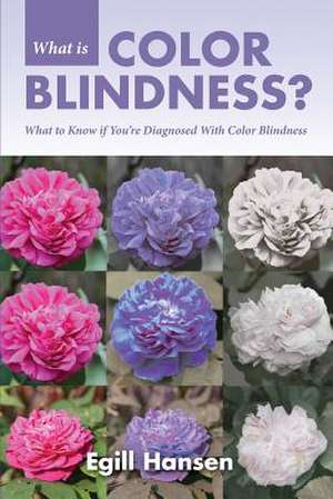 What Is Color Blindness? de Egill Hansen