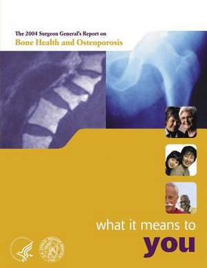 The 2004 Surgeon General's Report on Bone Health and Osteoporosis - What It Means to You de Department of Health and Human Services