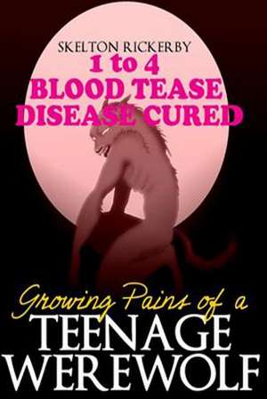 Growing Pains of a Teenage Werewolf Books 1 to 4 de Skelton Rockerby