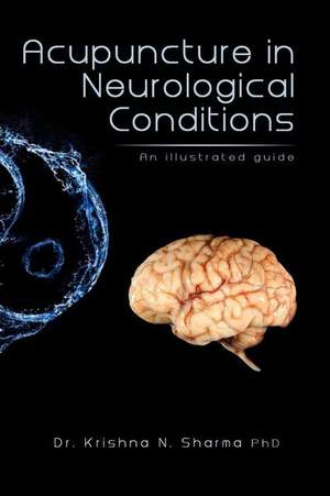 Acupuncture in Neurological Conditions de Krishna N. Sharma