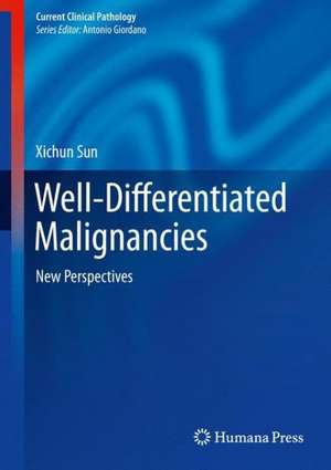 Well-Differentiated Malignancies: New Perspectives de Xichun Sun