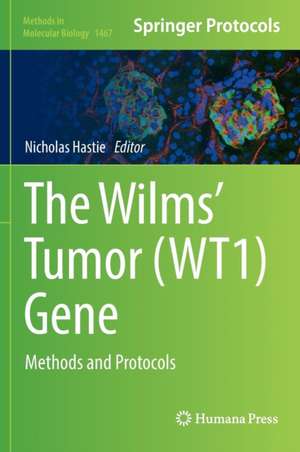 The Wilms' Tumor (WT1) Gene: Methods and Protocols de Nicholas Hastie