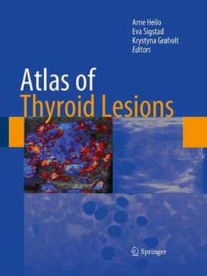 Atlas of Thyroid Lesions de Arne Heilo