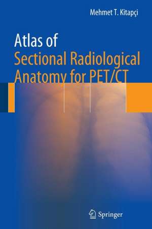 Atlas of Sectional Radiological Anatomy for PET/CT de Mehmet T. Kitapci