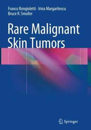 Rare Malignant Skin Tumors de Franco Rongioletti