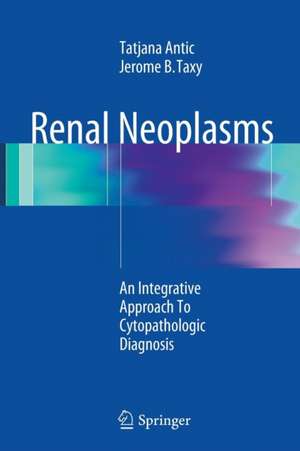 Renal Neoplasms: An Integrative Approach To Cytopathologic Diagnosis de Tatjana Antic