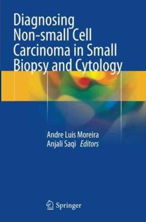 Diagnosing Non-small Cell Carcinoma in Small Biopsy and Cytology de Andre Luis Moreira