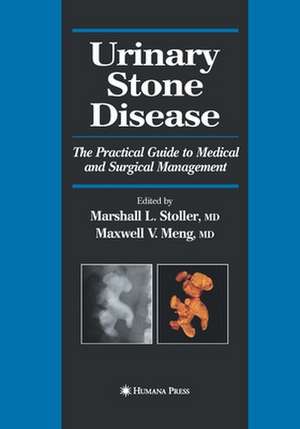 Urinary Stone Disease: The Practical Guide to Medical and Surgical Management de Marshall L. Stoller
