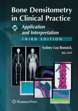 Bone Densitometry in Clinical Practice: Application and Interpretation de Sydney Lou Bonnick