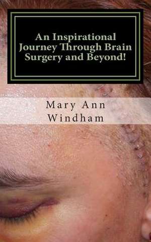 An Inspirational Journey Through Brain Surgery and Beyond! de Mary Ann Windham