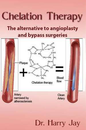 Chelation Therapy de Harry Jay