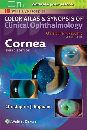 Cornea de Christopher Rapuano