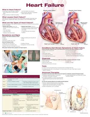 Heart Failure Anatomical Chart de Anatomical Chart Company