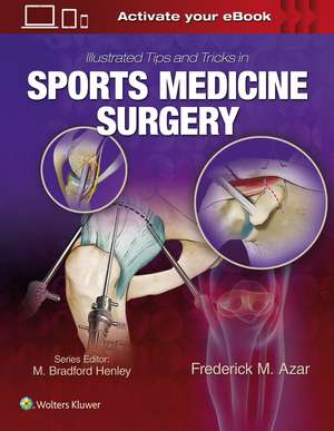 Illustrated Tips and Tricks in Sports Medicine Surgery de Dr. Frederick M. Azar MD, FAAOS