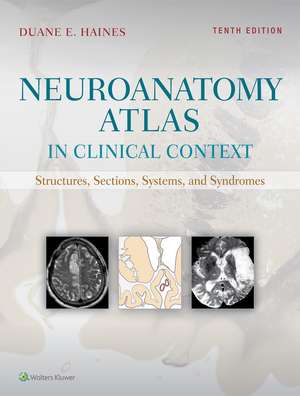 Neuroanatomy Atlas in Clinical Context: Structures, Sections, Systems, and Syndromes de Duane E. Haines PhD