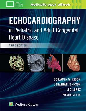 Echocardiography in Pediatric and Adult Congenital Heart Disease de Benjamin W. Eidem MD, FACC, FASE