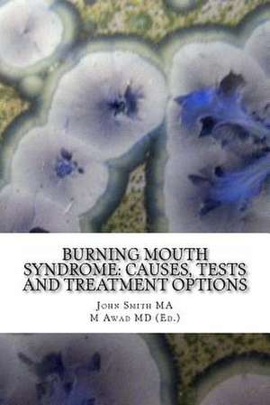 Burning Mouth Syndrome de John Smith Ma