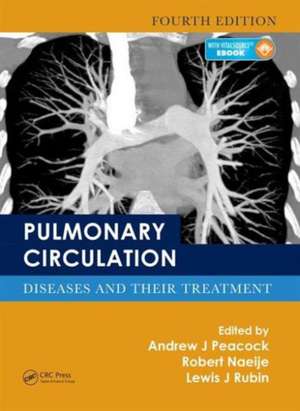 Pulmonary Circulation: Diseases and Their Treatment, Fourth Edition de Andrew J. Peacock