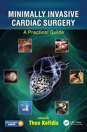 Minimally Invasive Cardiac Surgery: A Practical Guide de Theo Kofidis