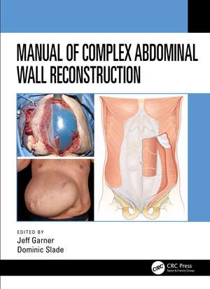 Manual of Complex Abdominal Wall Reconstruction de Jeff Garner