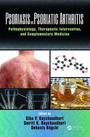 Psoriasis and Psoriatic Arthritis: Pathophysiology, Therapeutic Intervention, and Complementary Medicine de Siba P. Raychaudhuri