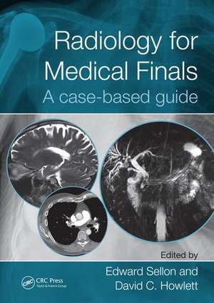 Radiology for Medical Finals: A case-based guide de Edward Sellon