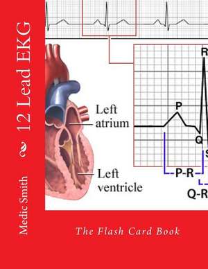 12 Lead EKG de Medic Smith