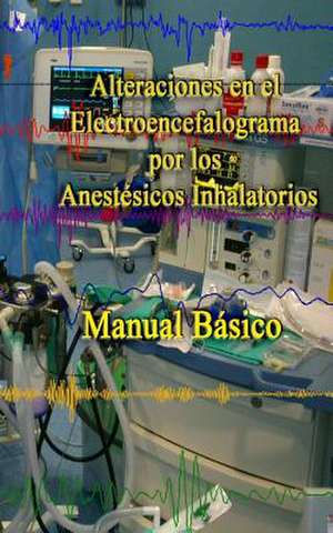 Alteraciones En El Electroencefalograma Por Los Anestesicos Inhalatorios de Eugenio Martinez Hurtado