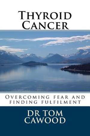 Thyroid Cancer de Dr Tom Cawood