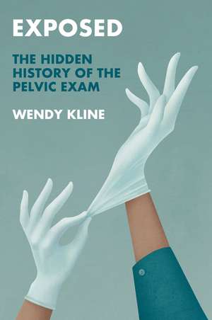 Exposed – The Hidden History of the Pelvic Exam de W Kline