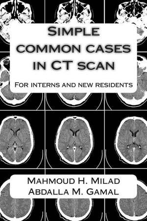 Simple Common Cases in CT Scan de Dr Abdalla M. Gamal