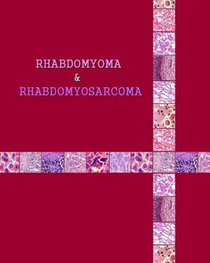 Rhabdomyoma & Rhabdomyosarcoma: Kinderbuch Uber Dinosaurier Mit Sagenhaften Bilder & Viel Wissenswertes de Naira Roland Matevosyan