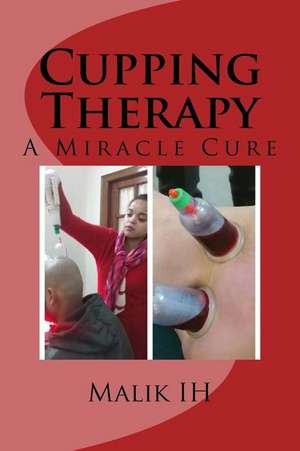 Cupping Therapy de Malik Ih