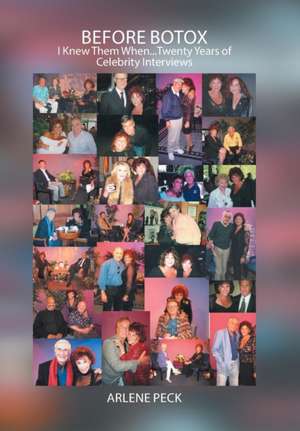 Before Botox de Arlene Peck