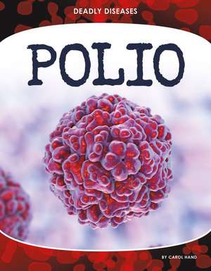 Hand, C: Polio
