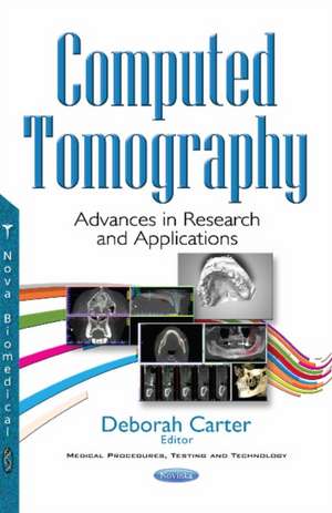 Computed Tomography: Advances in Research & Applications de Deborah Carter