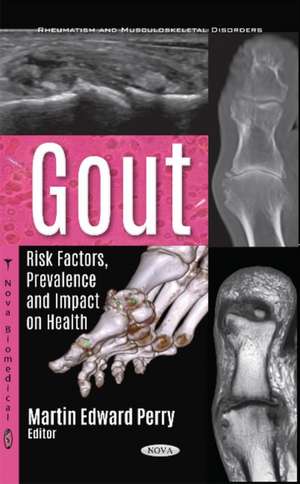 Gout: Risk Factors, Prevalence & Impact on Health de Martin Edward Perry