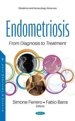 Endometriosis: From Diagnosis to Treatment de Simone Ferrero M.D., Ph.D.
