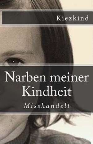 Narben Meiner Kindheit de Kiezkind