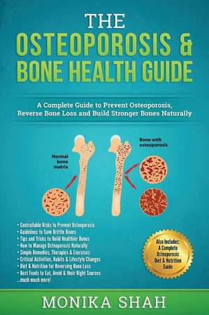 Osteoporosis de Monika Shah