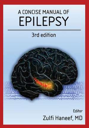 A Concise Manual of Epilepsy de Haneef, Zulfi