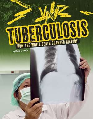 Tuberculosis: How the White Death Changed History de Mark K. Lewis