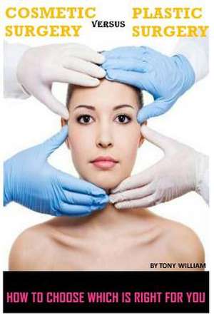 Cosmetic Surgery de William, Tony