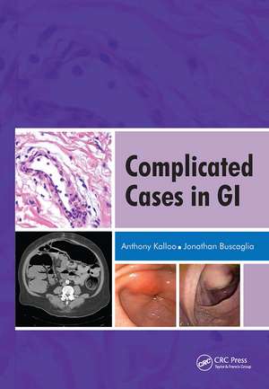 Complicated Cases in GI de Anthony Kalloo