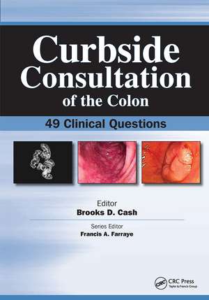 Curbside Consultation of the Colon: 49 Clinical Questions de Brookes Cash