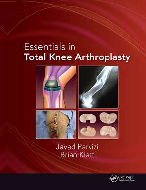 Essentials in Total Knee Arthroplasty de Javad Parvizi