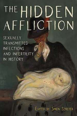 The Hidden Affliction – Sexually Transmitted Infections and Infertility in History de Simon Szreter