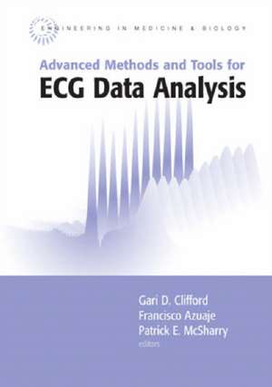 Advanced Methods and Tools for ECG Data Analysis de Gari D. Clifford