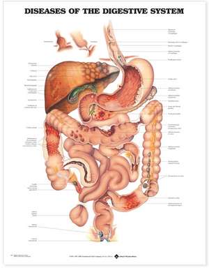 Diseases of the Digestive System Anatomical Chart de Anatomical Chart Company